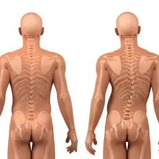 Bone alignment